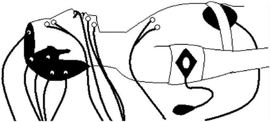 第一節(jié) 多導(dǎo)睡眠監(jiān)測